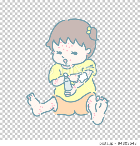 薬を塗るアトピーの女の子(パステルカラー) 薬を塗るアトピーの女の子(パステルカラー) 94805648