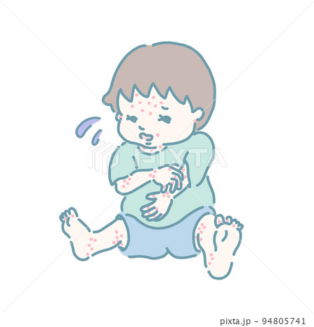 アトピーを掻きむしる男の子(パステルカラー) 94805741