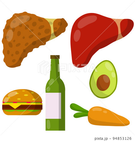 Healthy and diseased liver. Causes of illness the internal organ. Greasy Burger, alcohol beer, carrots, avocado. Medical diagnosis. Funny cartoon flat illustration. Set of Diet and good nutrition Healthy and diseased liver. Causes of illness the internal organ. Greasy Burger, alcohol beer, carrots, avocado. Medical diagnosis. Funny cartoon flat illustration. Set of Diet and good nutrition 94853126