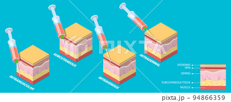 3D Isometric Flat Vector Conceptual Illustration of Injection Types 94866359