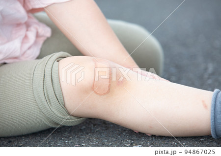 子どものけがをした場所に貼られた絆創膏 94867025