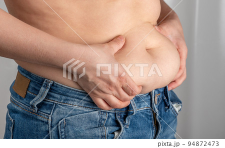 woman hand holding excessive belly fat, overweight concept. woman pinching her fat on her waist. after pregnancy. skin stretch marks fat woman belly woman hand holding excessive belly fat, overweight concept. woman pinching her fat on her waist. after pregnancy. skin stretch marks fat woman belly 94872473