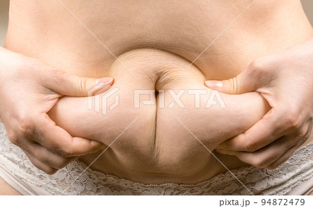 woman hand holding excessive belly fat, overweight concept. woman with fat belly, overweight female body, close-up studio shot. concept of dieting, losing weight 94872479