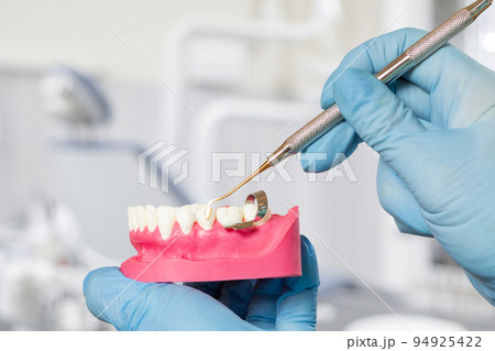 Dentist's hands with layout of the human jaw and dental restoration instrument. Dentist's hands with layout of the human jaw and dental restoration instrument. 94925422