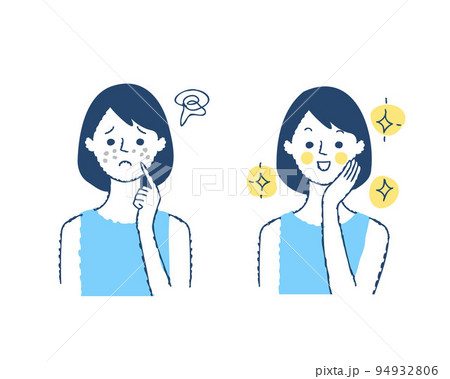肌の悩み　ビフォーアフター 94932806