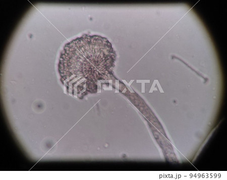 黒麹カビの分生子柄の写真 黒麹カビの分生子柄の写真 94963599