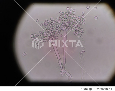 クモノスカビの胞子が胞子嚢からとびだいた様子 94964074