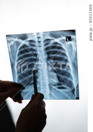 Doctor showing x-ray of patient's lungs. Doctor showing x-ray of patient's lungs. 95015369