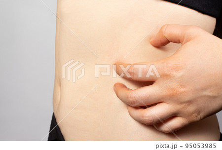 The woman scratches the skin of the side of the abdomen, scabies. Contagious skin disease, dermatitis and skin itching. Allergic urticaria The woman scratches the skin of the side of the abdomen, scabies. Contagious skin disease, dermatitis and skin itching. Allergic urticaria 95053985