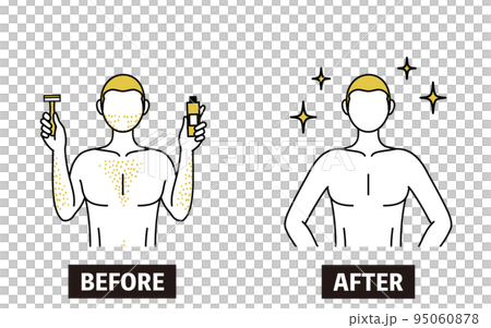 The image of unwanted hair removal, the image of a man suffering from thick body hair shaving his hair or treating it with a depilatory cream to become full of confidence. The image of unwanted hair removal, the image of a man suffering from thick body hair shaving his hair or treating it with a depilatory cream to become full of confidence. 95060878
