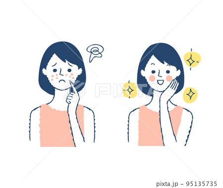 肌の悩み　ビフォーアフター 95135735