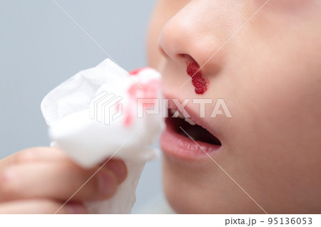 鼻血が出る小学生の女の子 (血のりでイメージ) 95136053