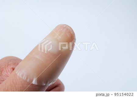 親指、手当て、治療、指、パーツ、傷、手、左手、ボディパーツ、バンドエイド、男性、男、成人男性、人物 親指、手当て、治療、指、パーツ、傷、手、左手、ボディパーツ、バンドエイド、男性、男、成人男性、人物 95154022