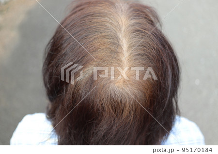 薄毛女性　白髪　シニア 95170184