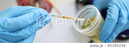 Doctor urologist making express urine test using indicator paper closeup 95204256