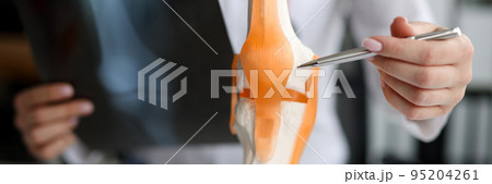 Doctor with xray in his hands showing structure of knee joint on artificial model closeup Doctor with xray in his hands showing structure of knee joint on artificial model closeup 95204261