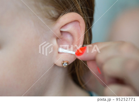 Cleaning the ears of a 5-year-old child from...の写真素材