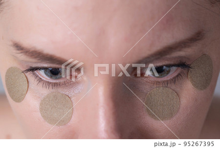 Medical medical plaster for relieving fatigue and tension from the eyes of a girl, macro Medical medical plaster for relieving fatigue and tension from the eyes of a girl, macro 95267395