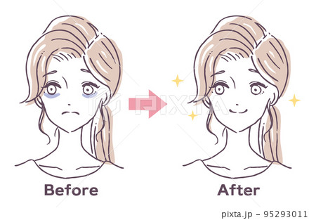 目のクマの治療ビフォーアフター 目下の隈に悩む女の人 不眠症 寝不足 人物イラスト素材 目のクマの治療ビフォーアフター 目下の隈に悩む女の人 不眠症 寝不足 人物イラスト素材 95293011