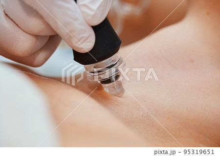 A cosmetologist performs hydropiling in a beauty salon. Skin care. A cosmetologist performs hydropiling in a beauty salon. Skin care. 95319651