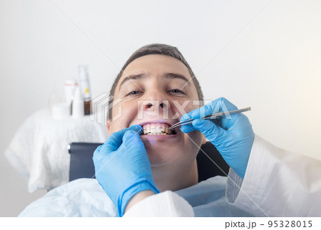 Installation of braces, bridges and a dental plate to correct teeth. An orthodontist installs a bracket system on an uneven jaw. Implants and smile correction. Concept of working in the dentist office 95328015