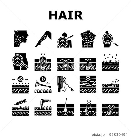 Ingrown Hair Problem Treatment Icons Set Vector 95330494
