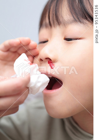 鼻血が出る小学生の女の子 (血のりでイメージ) 95343536