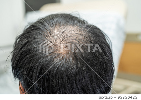Bald in the middle head and begin no loss hair glabrous of mature Asian business smart active office man. 95350425