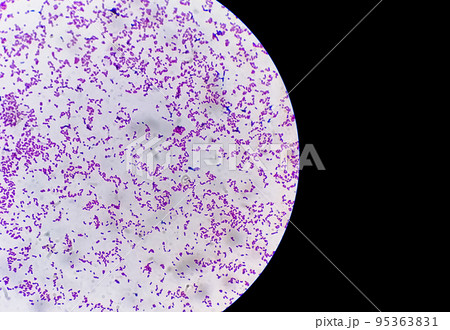 Gram staining, also known as Gram's method, is a method of differentiating bacterial species into two large groups (Gram positive and Gram negative). Gram staining, also known as Gram's method, is a method of differentiating bacterial species into two large groups (Gram positive and Gram negative). 95363831