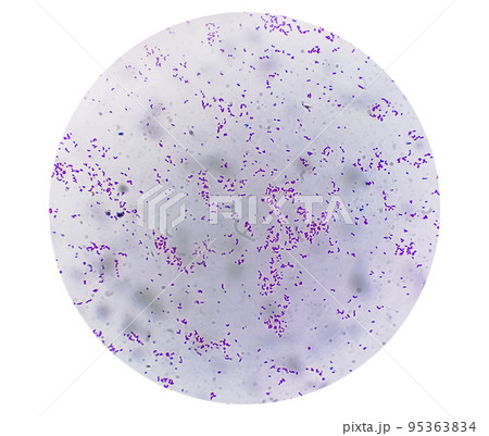 Gram staining, also known as Gram's method, is a method of differentiating bacterial species into two large groups (Gram positive and Gram negative). Gram staining, also known as Gram's method, is a method of differentiating bacterial species into two large groups (Gram positive and Gram negative). 95363834