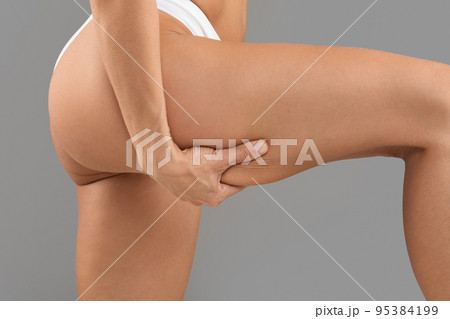 Closeup Shot Of Young Slim Woman Pulling Skin On Her Thigh With Hand Closeup Shot Of Young Slim Woman Pulling Skin On Her Thigh With Hand 95384199