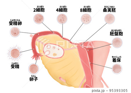 ヒトの受精から着床までの図解 日本語のイラスト素材 [95393305] - PIXTA