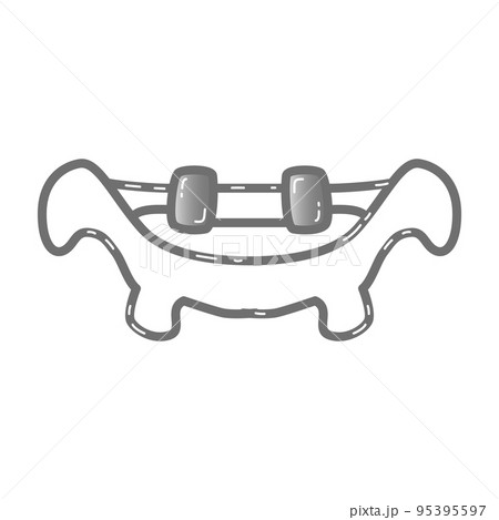 歯科矯正器具のイラスト 歯科矯正器具のイラスト 95395597