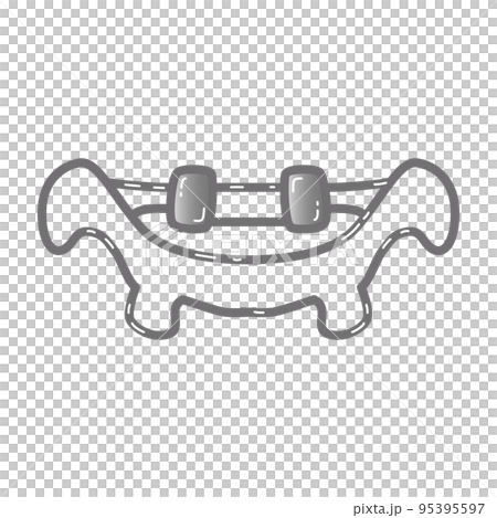 歯科矯正器具のイラスト 歯科矯正器具のイラスト 95395597