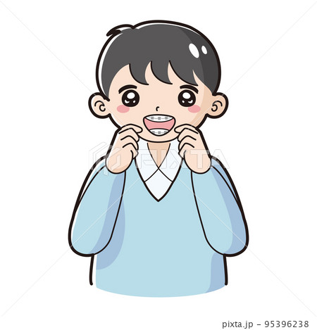 歯科矯正のワイヤーを装着した子どものイラスト 95396238