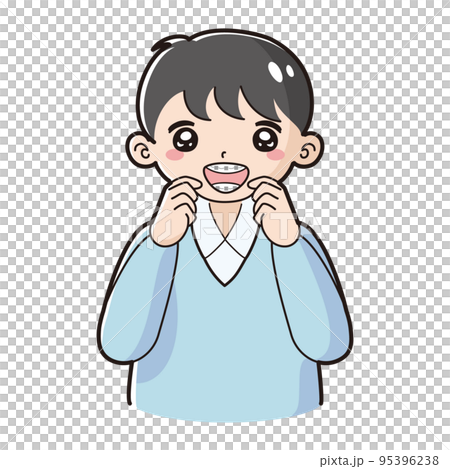 歯科矯正のワイヤーを装着した子どものイラスト 95396238