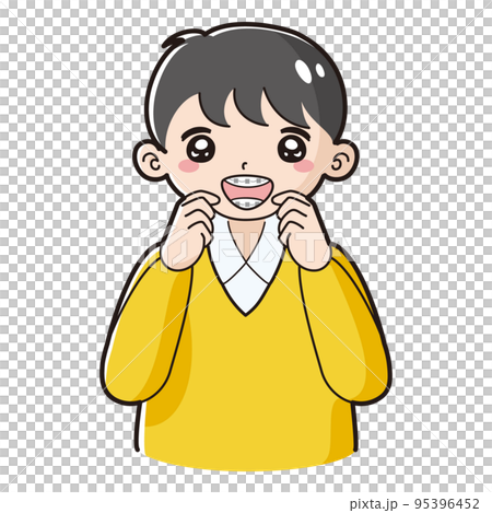 歯科矯正のワイヤーを装着した子どものイラスト 95396452