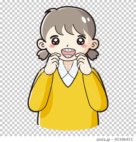 Illustration of a child wearing an orthodontic wire Illustration of a child wearing an orthodontic wire 95396453