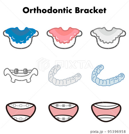 歯科矯正器具のイラストセットのイラスト素材 [95396958] - PIXTA