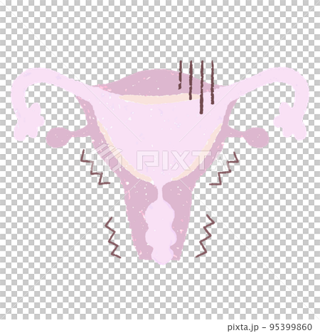 手繪不健康的子宮 95399860