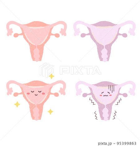 手描きの元気な子宮と元気がない子宮 手描きの元気な子宮と元気がない子宮 95399863