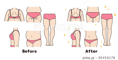 ダイエット　ビフォーアフターのセット 95459176