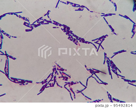 納豆菌の観察 95492814