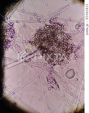 米麴カビの顕微鏡写真 米麴カビの顕微鏡写真 95492815