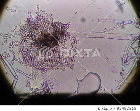黒コウジカビの顕微鏡写真 95492819