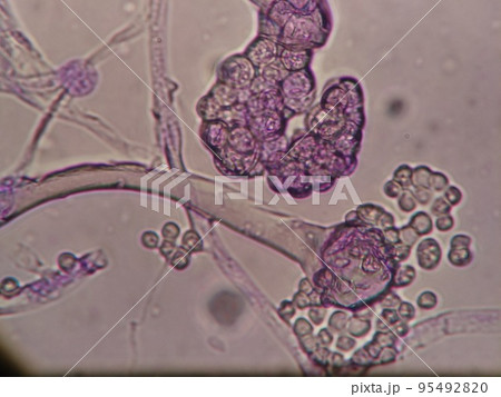 テンペ菌の胞子が飛び出したところ 95492820