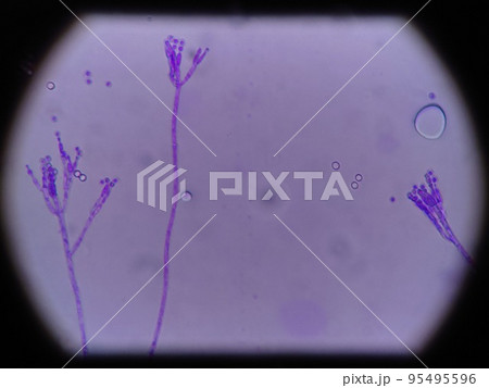 ペニシリウムの分生胞子 ペニシリウムの分生胞子 95495596