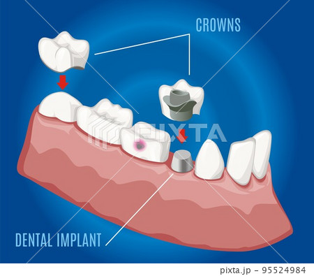 Isometric Professional Prosthetic Stomatology Template 95524984