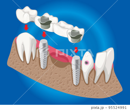 Isometric Prosthetic Dentistry Concept 95524991
