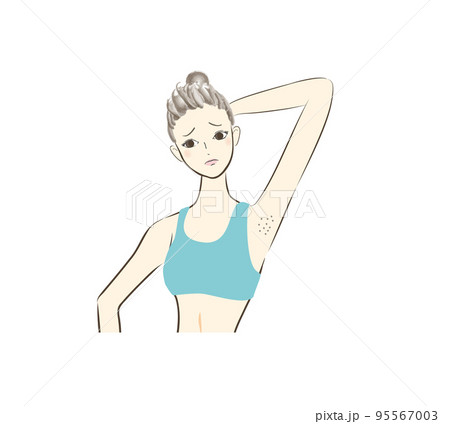 女性　わき脱毛　イラスト　剃り跡 95567003